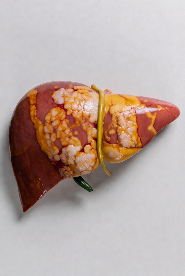 برنامه هفتگی رژیم غذایی کبد چرب