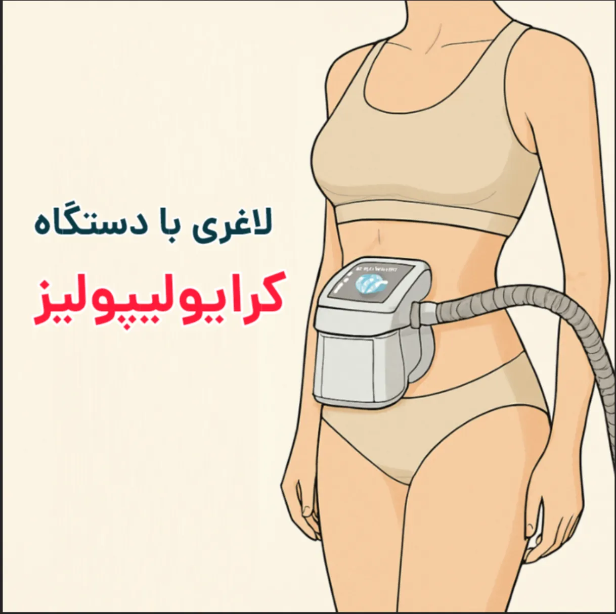 مزایا و عوارض کرایولیپولیز برای لاغری شکم و پهلو بدون جراحی